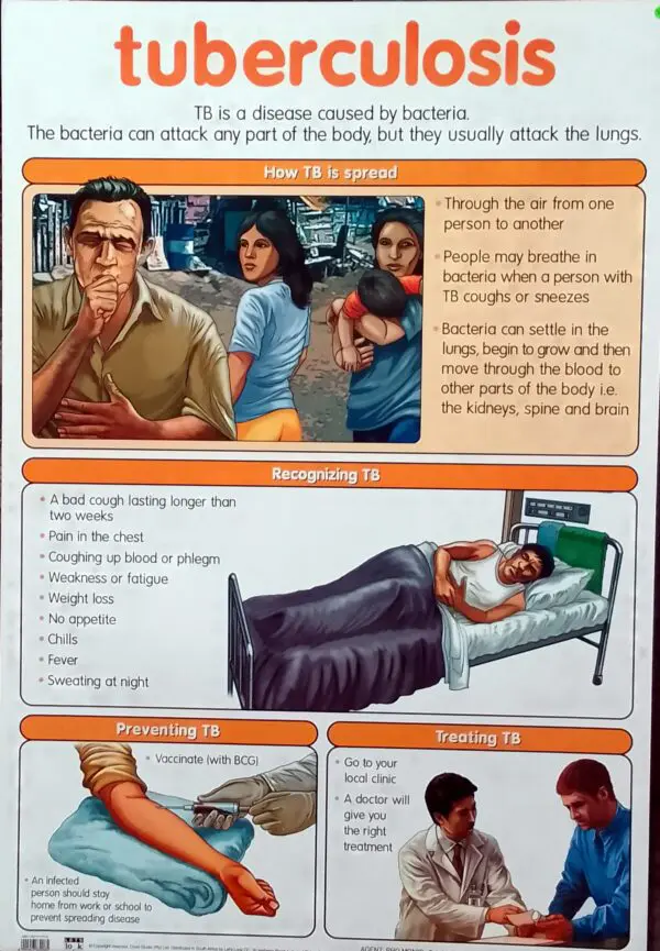 Tuberculosis - Wall Chart - Laminated 76cm x 52cm